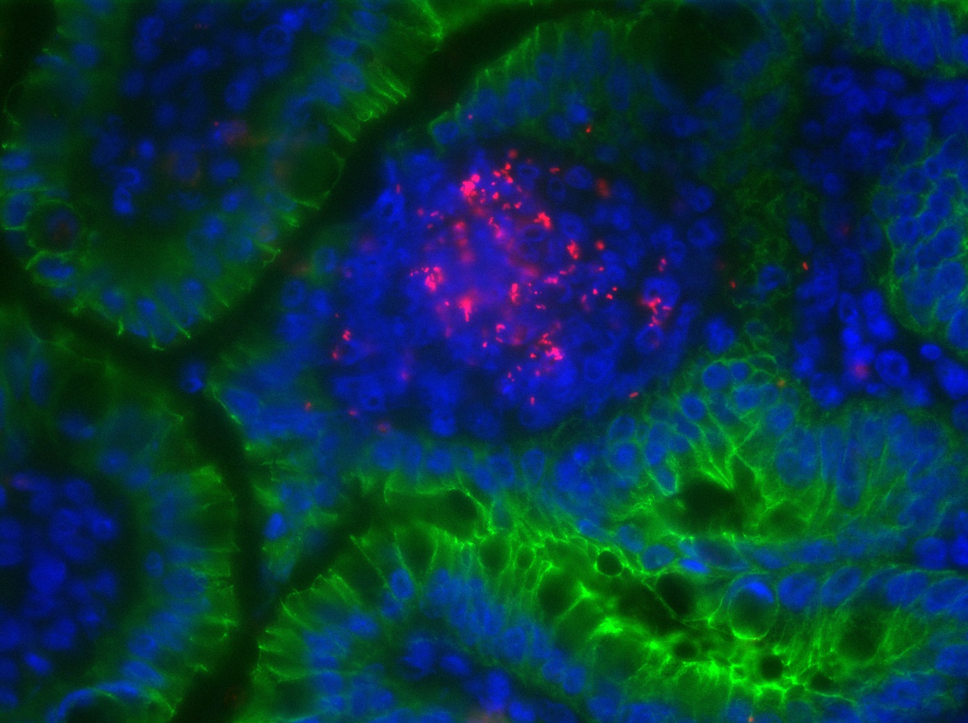 Listeria monocytogenes (rouge/red) - Institut Pasteur