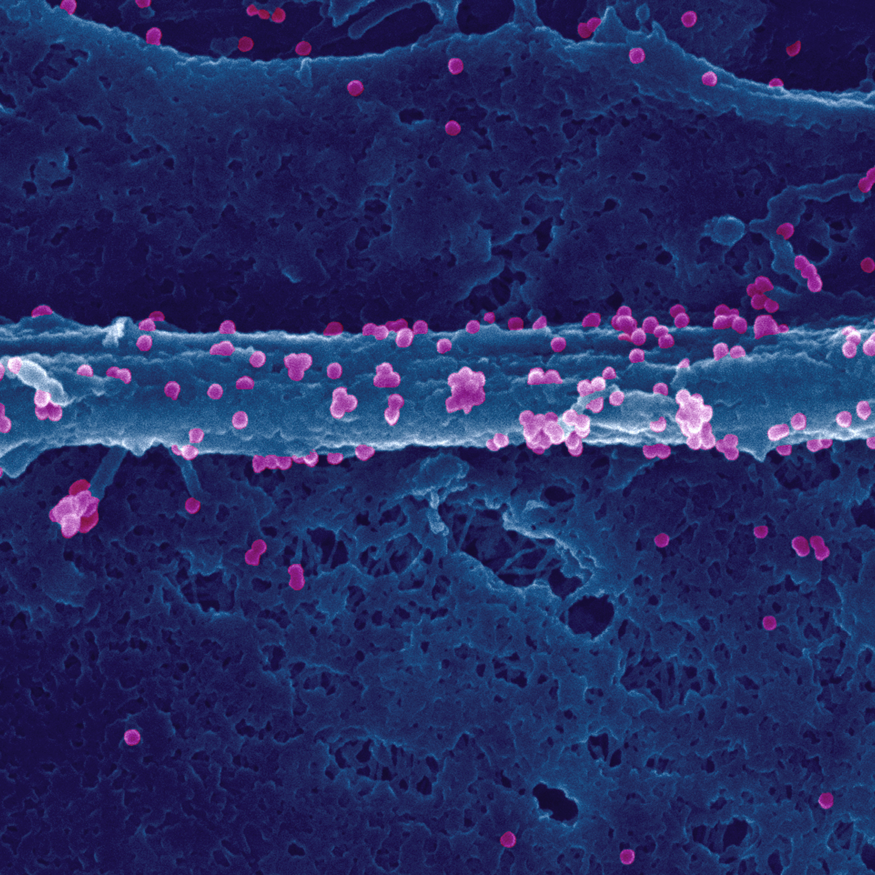 Virus chikungunya à la surface d'une cellule infectée - Institut Pasteur Virus chikungunya à la surface d'une cellule infectée - Institut Pasteur