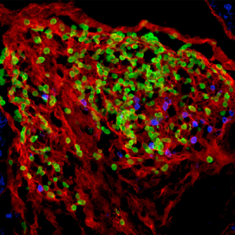 Un ganglion lymphatique en développement dans un foetus - Institut Pasteur Un ganglion lymphatique en développement dans un foetus - Institut Pasteur
