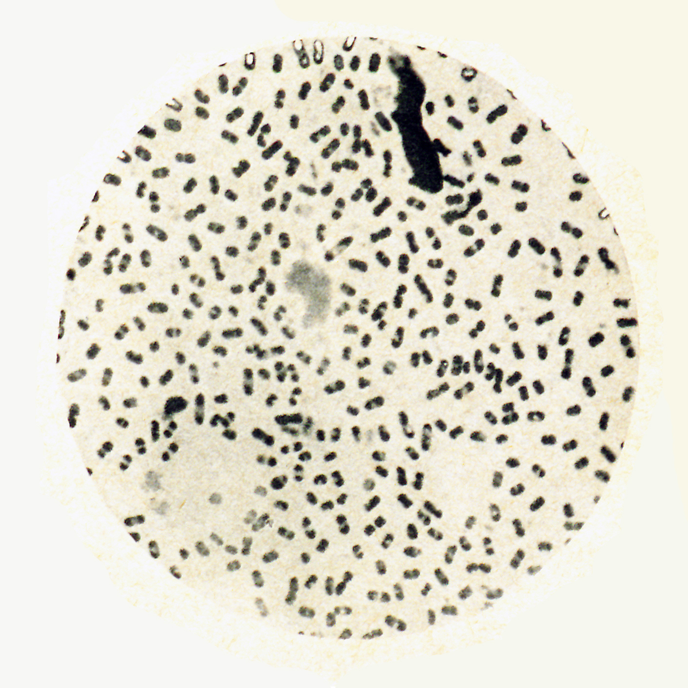 La peste bubonique à Hong-Kong par le Dr Yersin - Institut Pasteur La peste bubonique à Hong-Kong par le Dr Yersin - Institut Pasteur