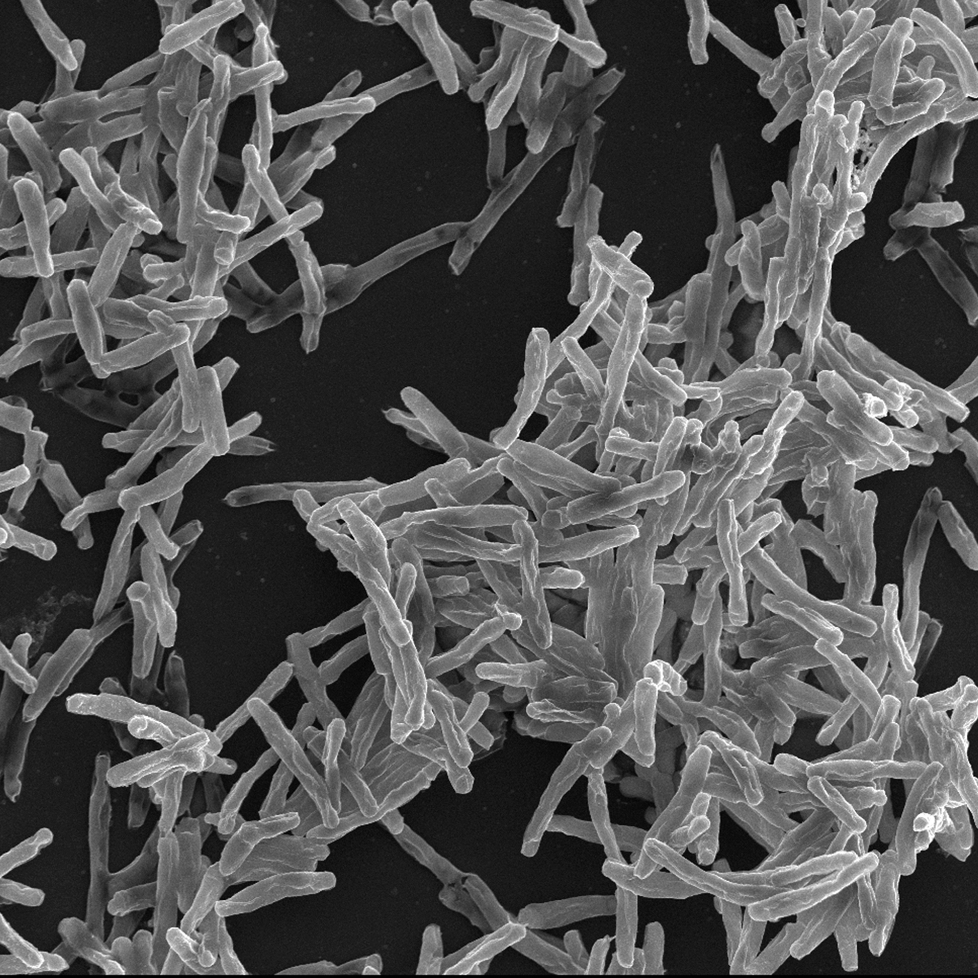 Mycobacterium tuberculosis, agent de la tuberculose - Institut Pasteur Mycobacterium tuberculosis, agent de la tuberculose - Institut Pasteur