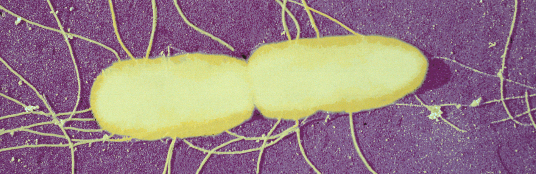 Santé Publique - CCOMS - Salmonella - Institut Pasteur