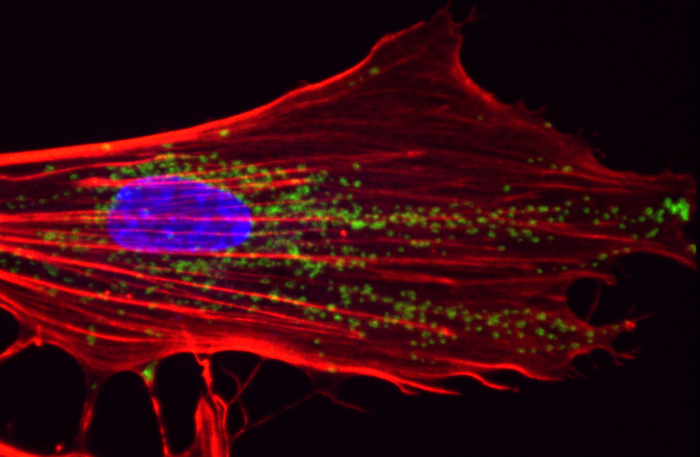 fibroblaste syndrome Cockayne - Institut Pasteur fibroblaste syndrome Cockayne - Institut Pasteur