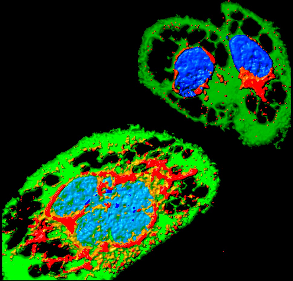Zika infection - Institut Pasteur