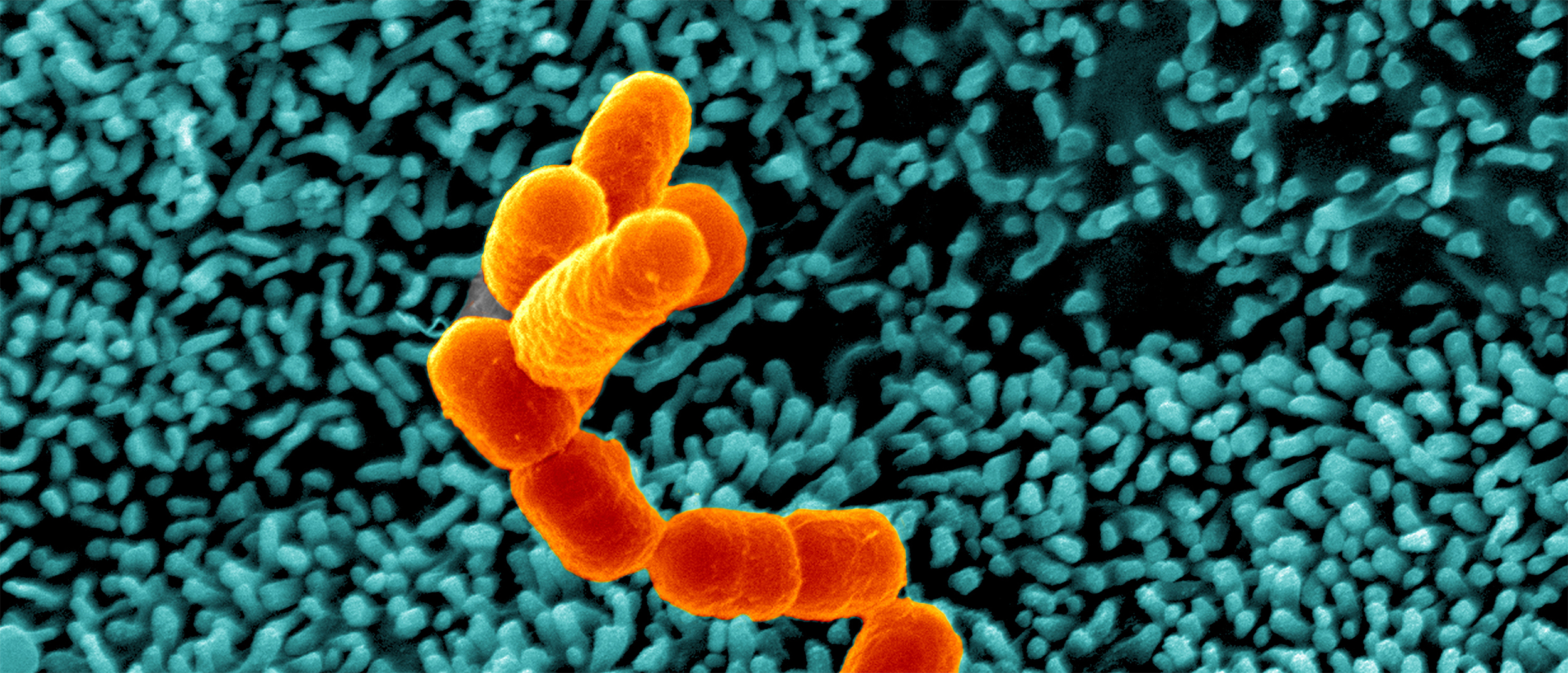 Escherichia coli, Shigella, Salmonella - Institut Pasteur Escherichia coli, Shigella, Salmonella - Institut Pasteur