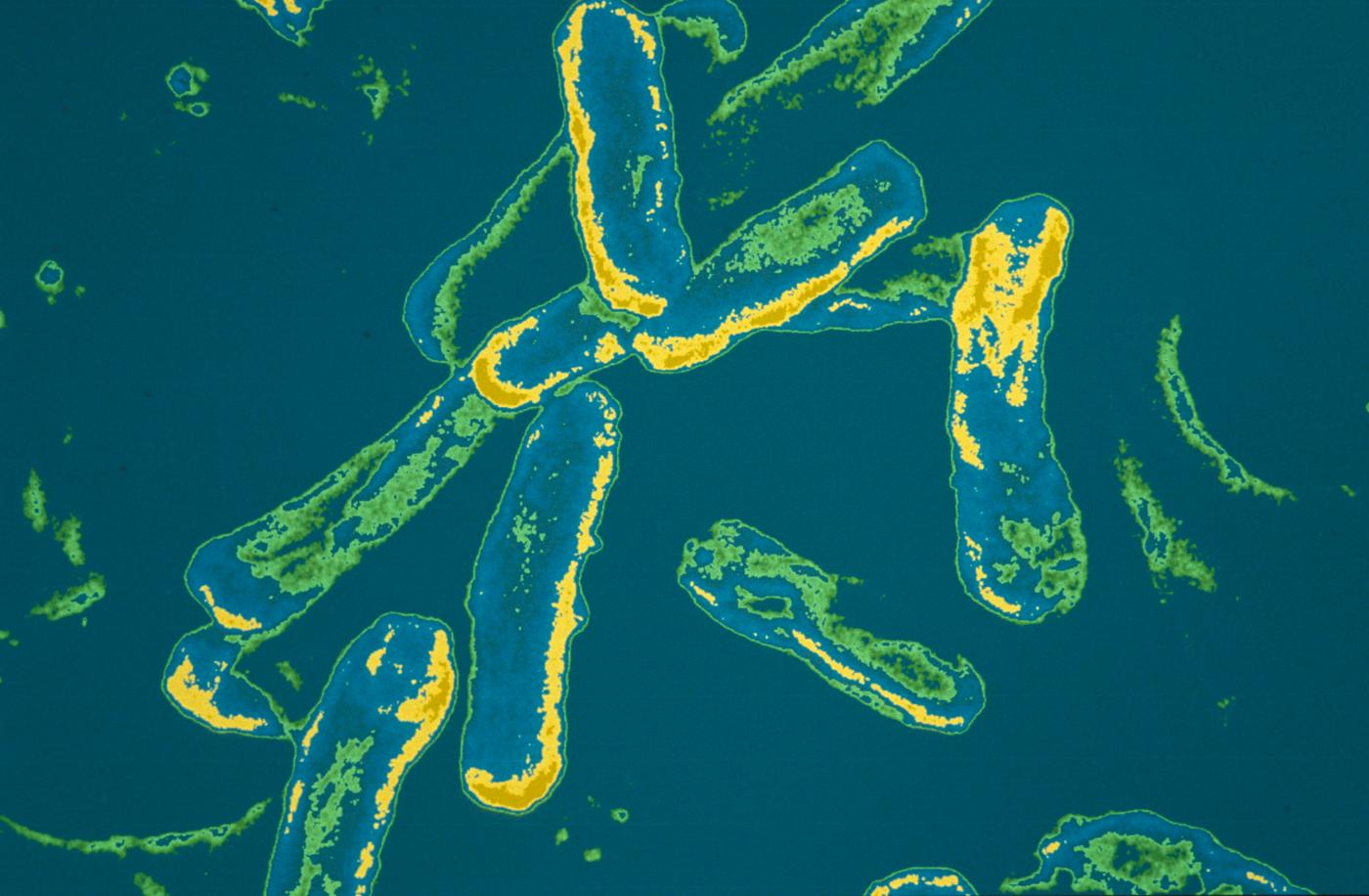 pseudomonas aeruginosa - Institut Pasteur pseudomonas aeruginosa - Institut Pasteur