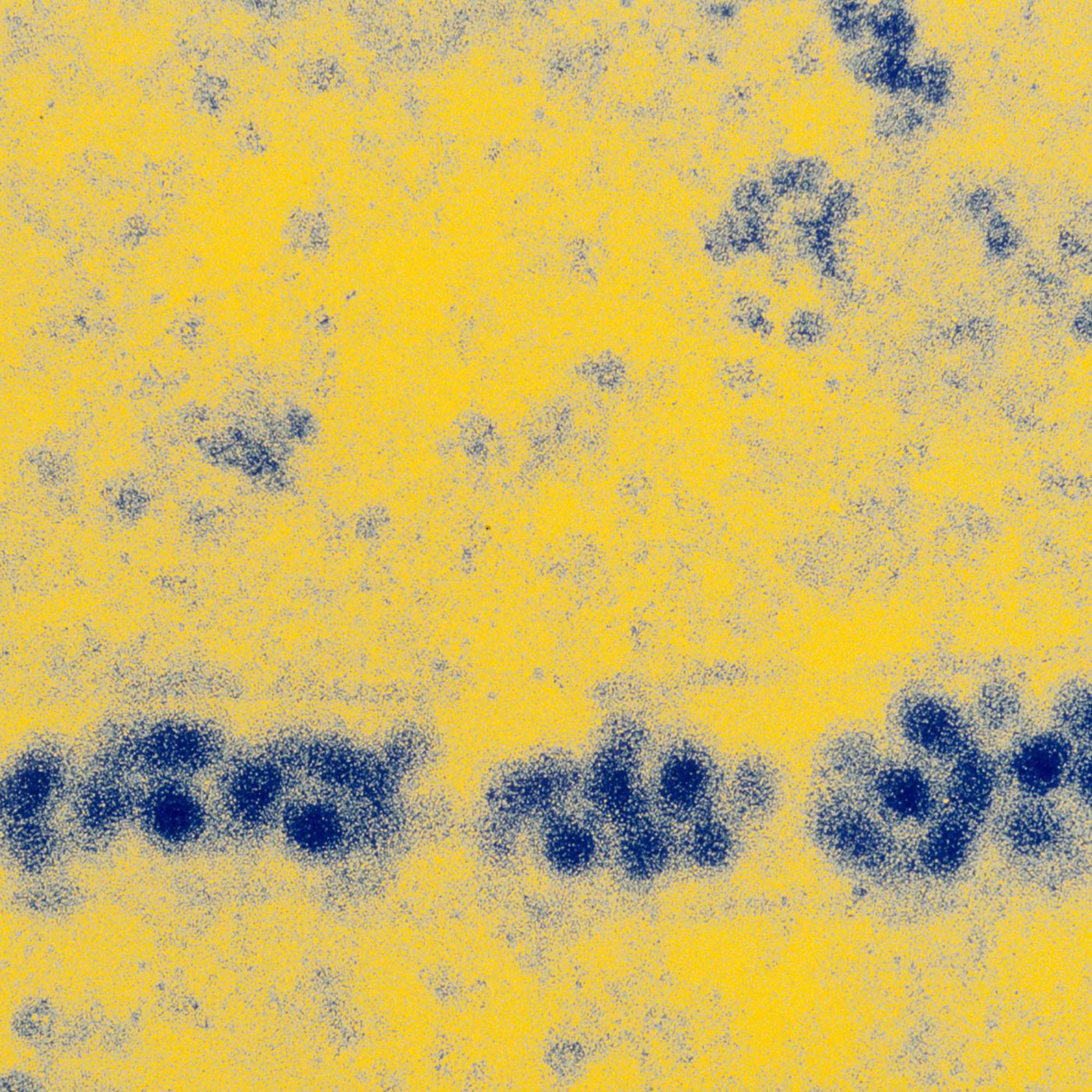 Virus de la fièvre jaune - Institut Pasteur Virus de la fièvre jaune - Institut Pasteur