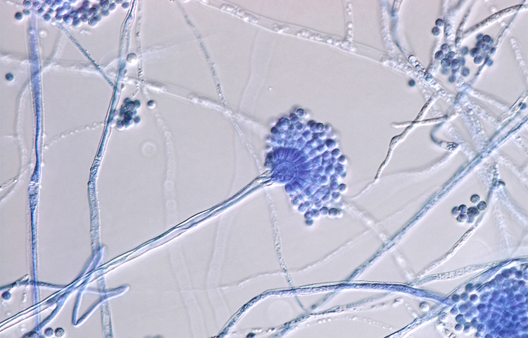 Antimicrobial resistance - Institut Pasteur Antimicrobial resistance - Institut Pasteur