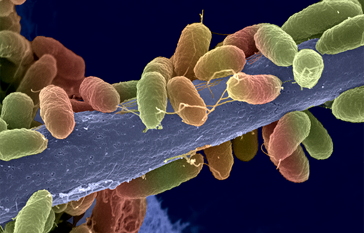 Antimicrobial resistance - Institut Pasteur Antimicrobial resistance - Institut Pasteur