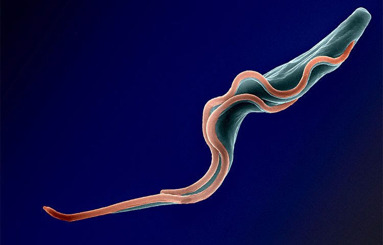 Antimicrobial resistance Antimicrobial resistance