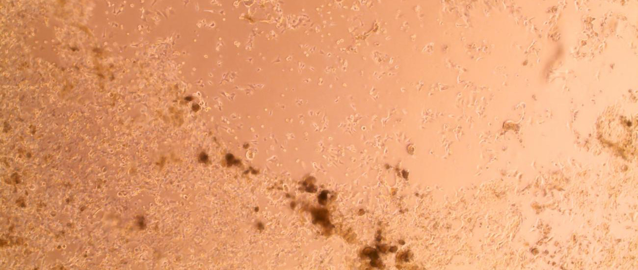 L’Institut Pasteur isole les souches du coronavirus 2019-nCoV détecté en France L’Institut Pasteur isole les souches du coronavirus 2019-nCoV détecté en France