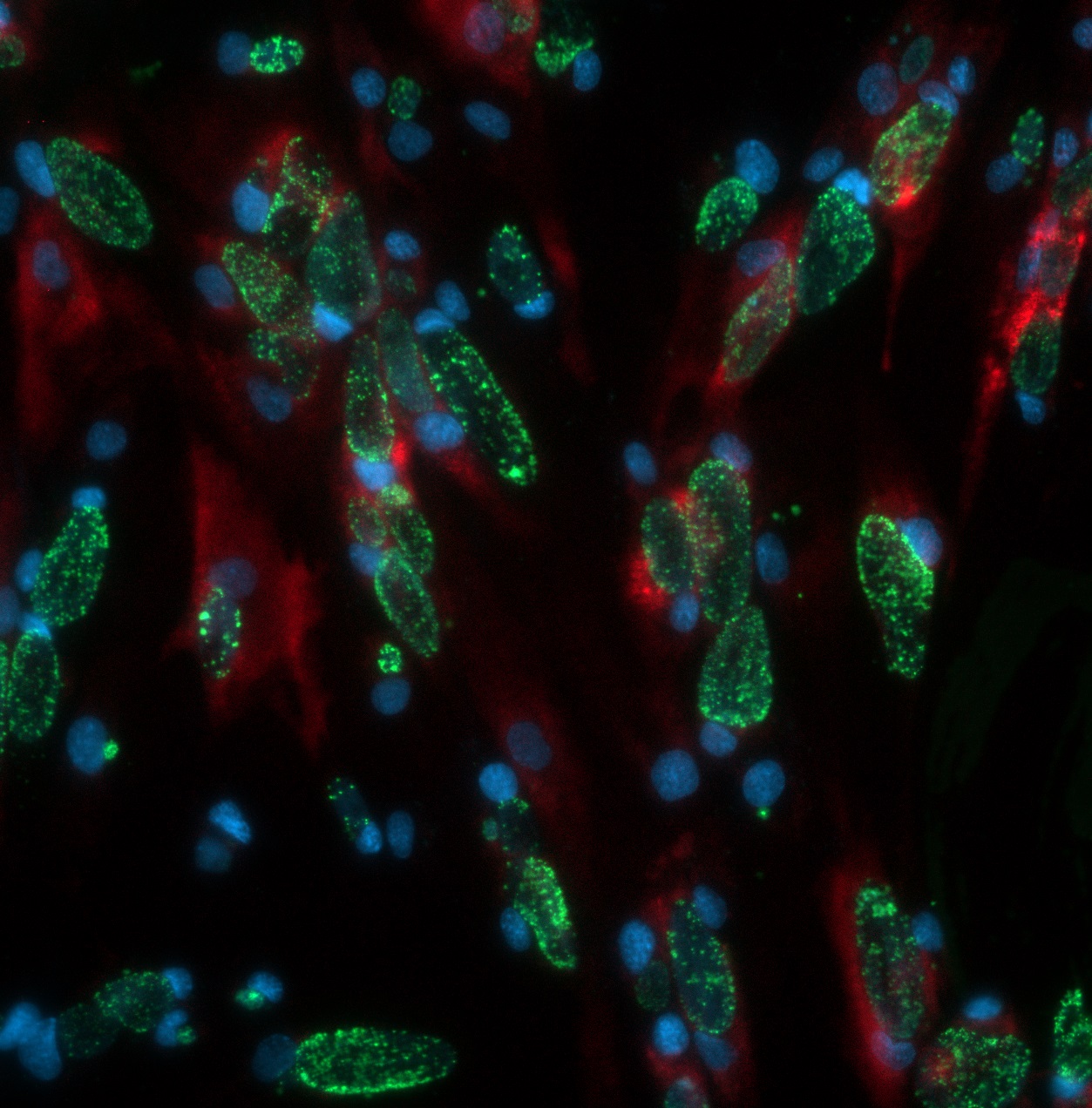 Chlamydia trachomatis - Institut Pasteur Chlamydia trachomatis - Institut Pasteur