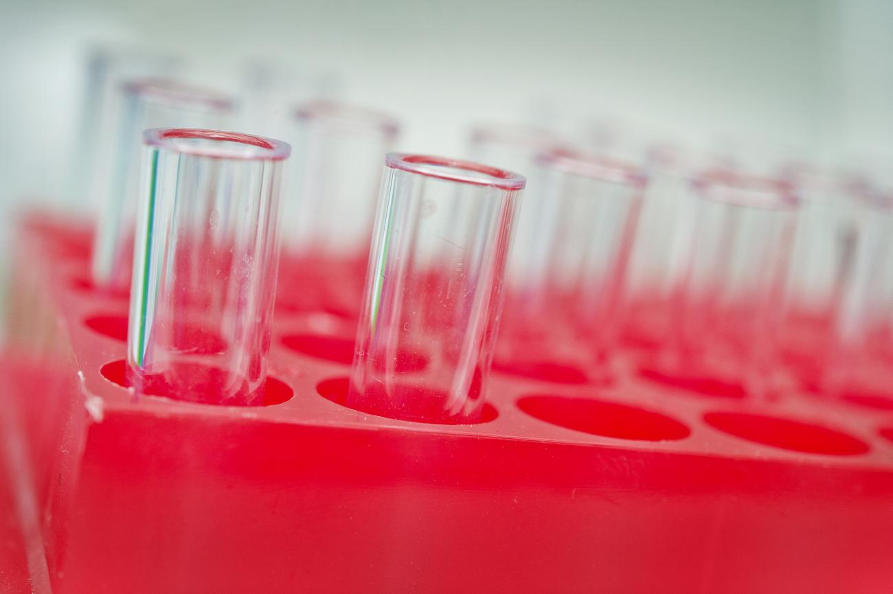 COVID-19 : un projet vaccin lentiviral par voie intra-nasale assure une protection importante chez l’animal COVID-19 : un projet vaccin lentiviral par voie intra-nasale assure une protection importante chez l’animal
