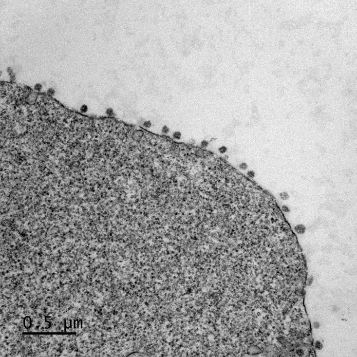 Image de microscopie électronique montrant l’accumulation de particules virales à la surface de cellules dérivées d’un cerveau de chauve-souris