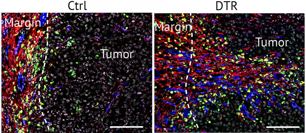 Les cellules stromales en marge d'une tumeur © Institut pasteur Les cellules stromales en marge d'une tumeur © Institut pasteur