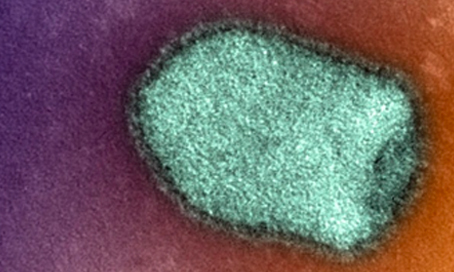 Virus de la rage en microscopie électronique - Institut Pasteur