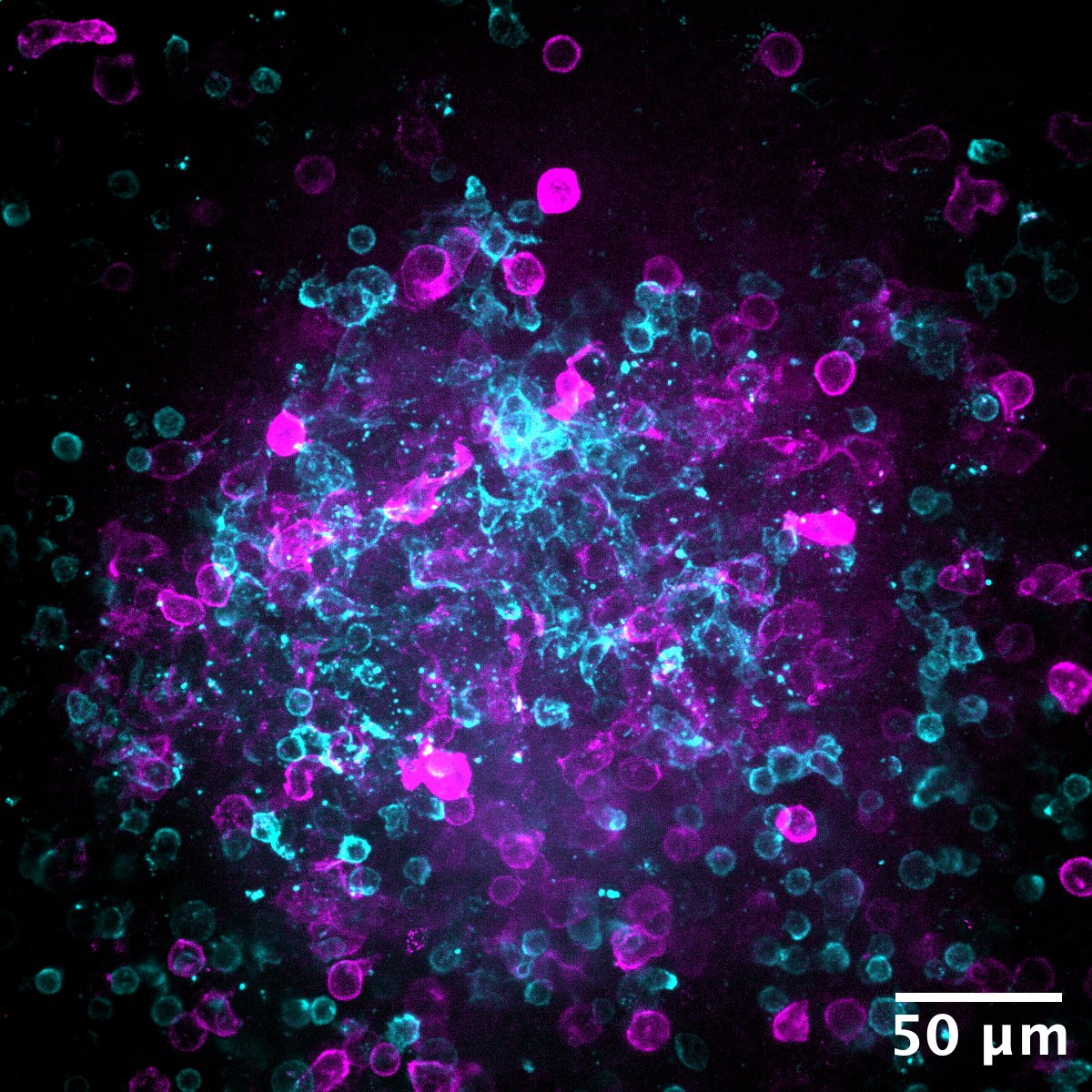 les cellules T activées (en violet) et les lymphocytes B (en bleu) s’agglutinent pour favoriser la production d’anticorps