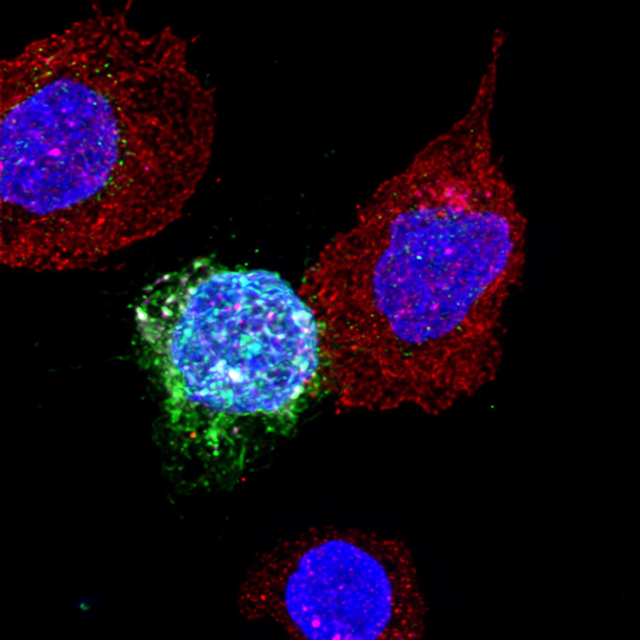 Cellules CD8 de patients contrôleurs en contact avec des cellules CD4 infectées par le VIH