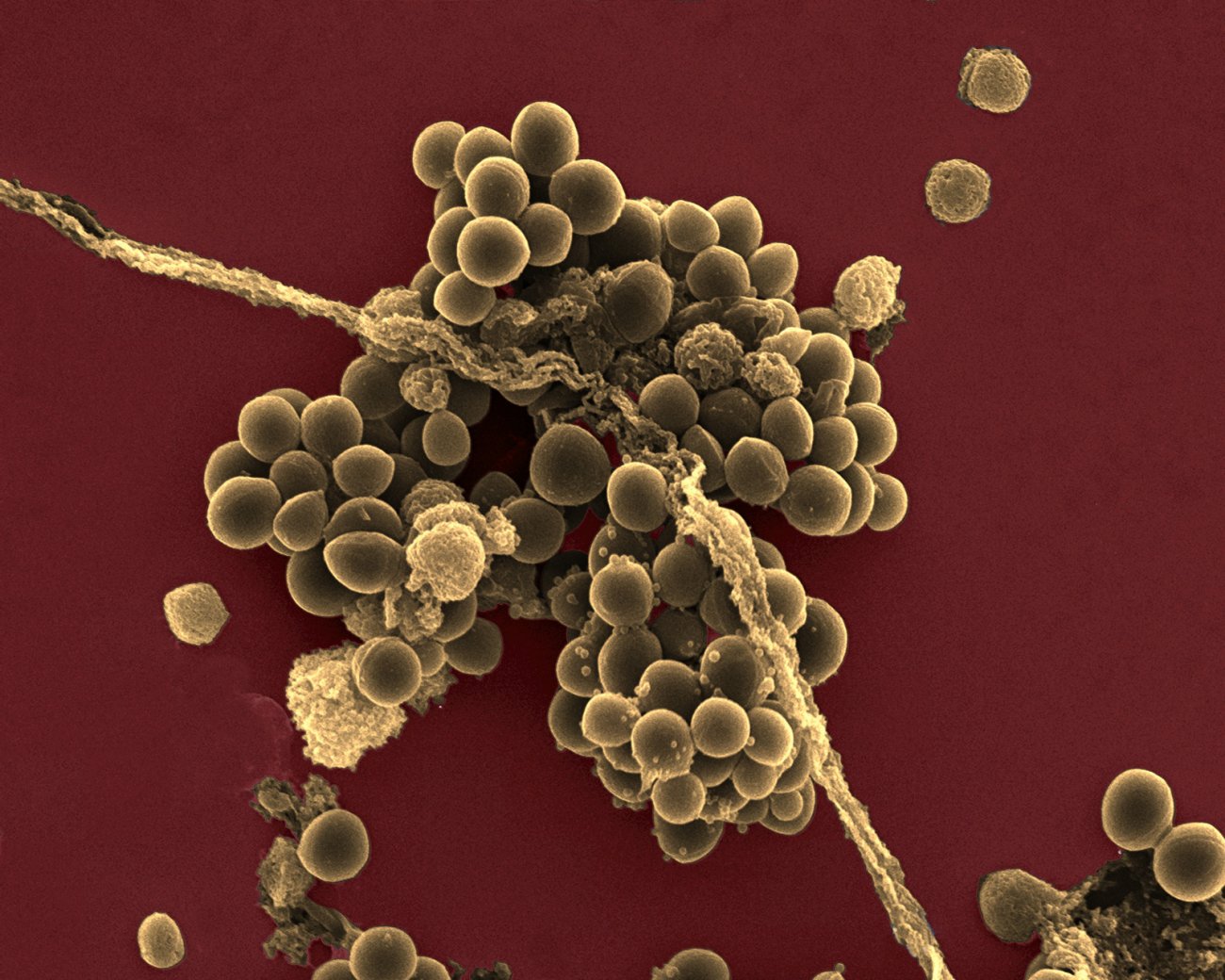 Bactéries Staphylococcus aureus (staphylocoque doré) vues en microscopie électronique à balayag