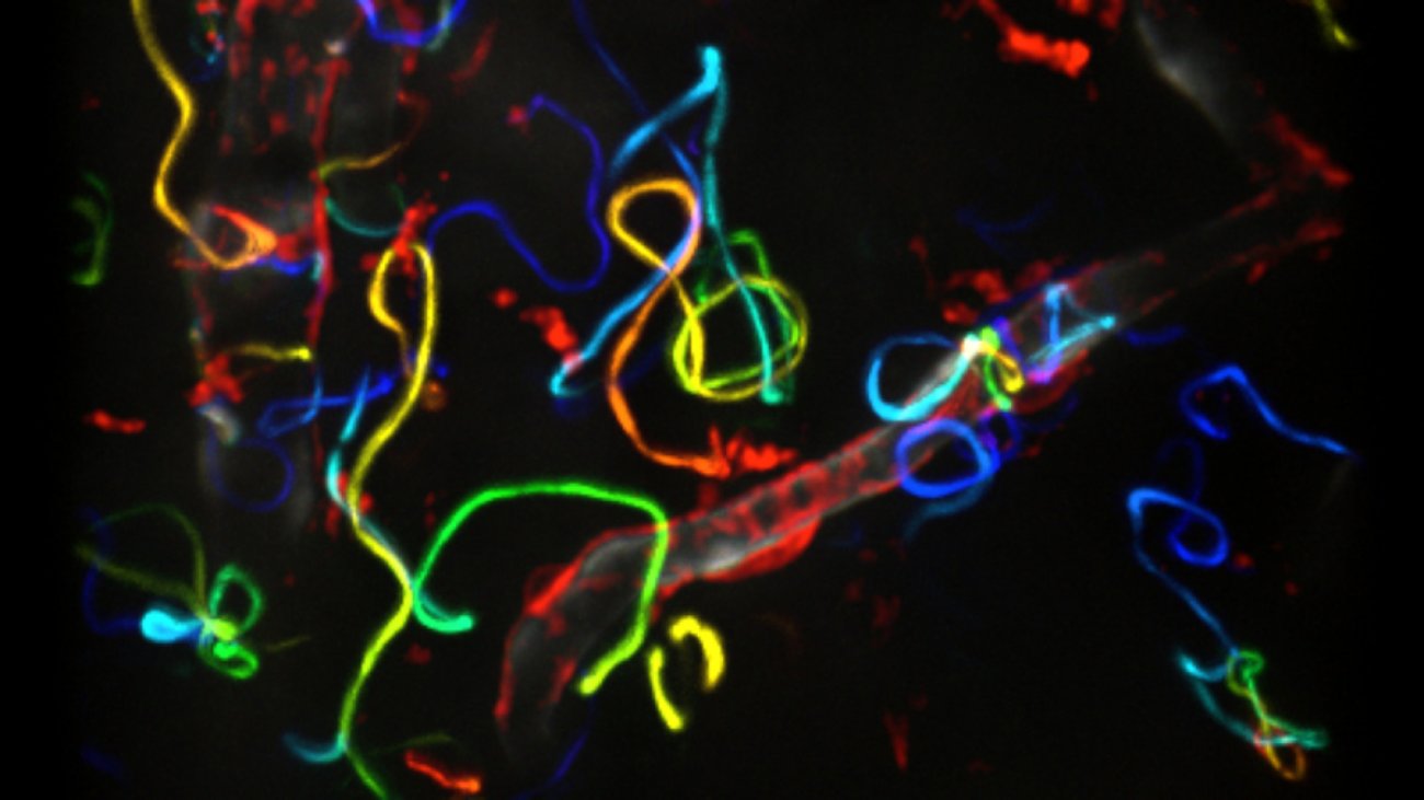 Migration des sporozoïtes de Plasmodium dans la peau.
