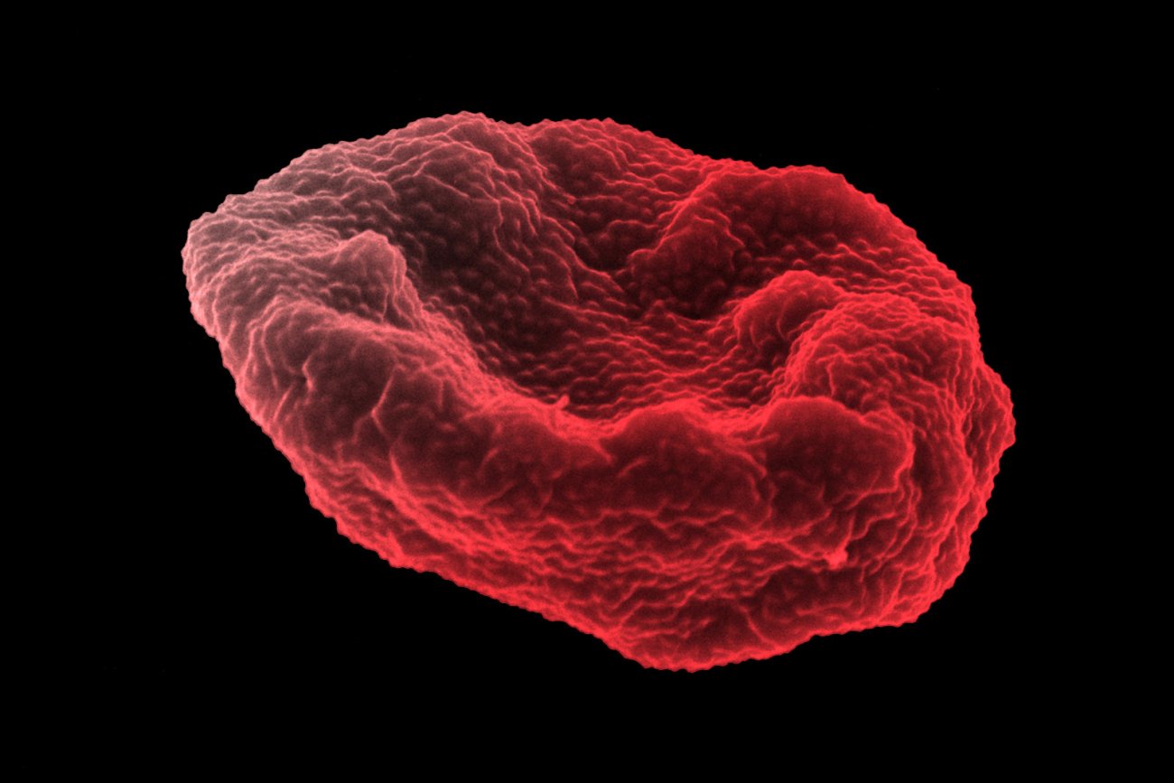 Globule rouge humain infecté par Plasmodium falciparum