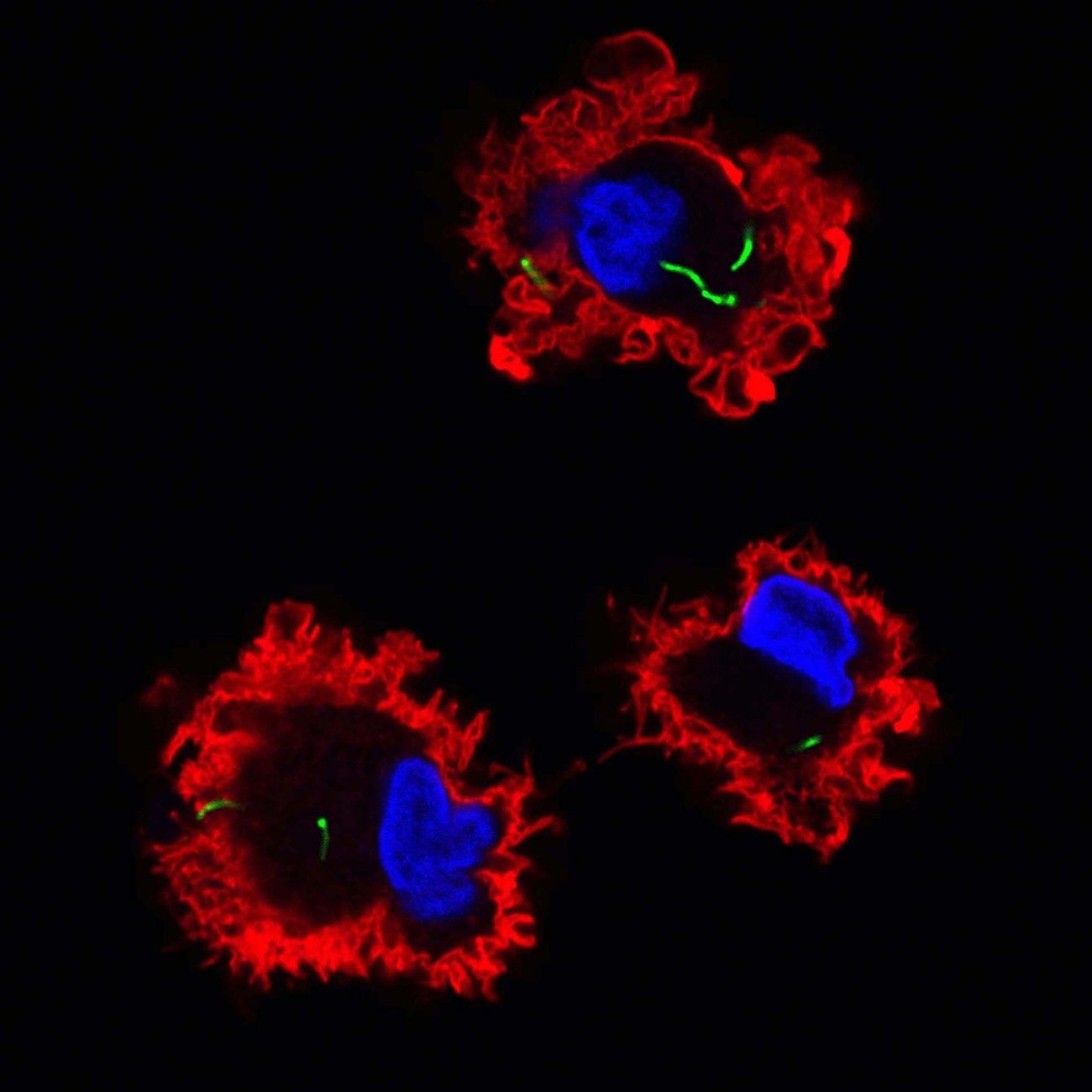 Le bacille de la tuberculose (en vert) entre dans les cellules dendritiques (en rouge). La microscopie confocale, ici utilisée, a eu un impact important pour certaines découvertes récentes concernant cette maladie.