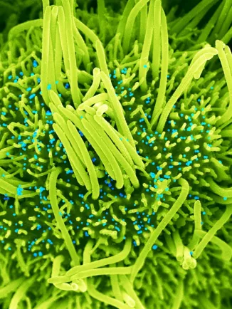 Human bronchial cells (green) infected with SARS-CoV-2 (blue) - Institut Pasteur