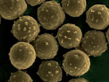 Fiche Maladie - Aspergillose - Institut Pasteur