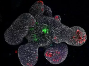 Goblet cell Listeria - Institut Pasteur