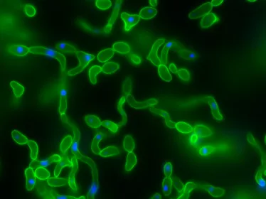 Fiches maladies - Candidoses - Institut Pasteur