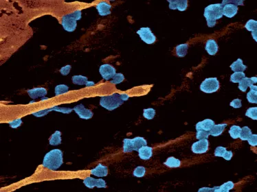Fiches maladies -Chikungunya - Institut Pasteur