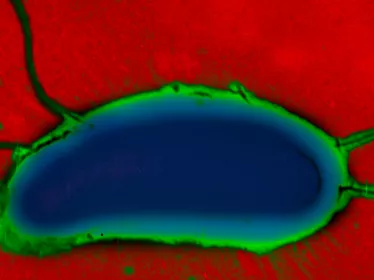 Fiches maladies - Choléra - Institut Pasteur