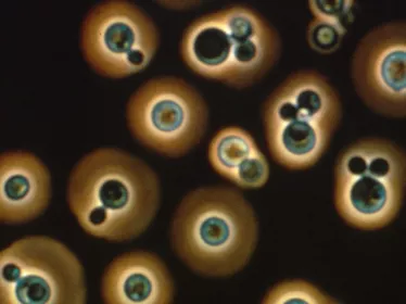 Fiches maladies - Cryptococcose - Institut Pasteur