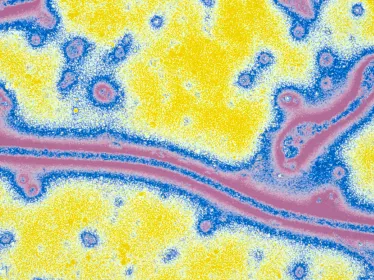 Fiches maladies - Ebola - Institut Pasteur
