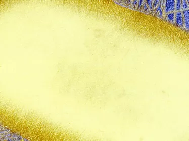 Fiches maladies - Escherichia Coli - Institut Pasteur
