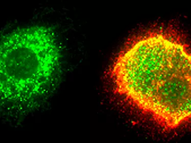 Fiches maladies - Fièvre de Lassa - Institut Pasteur