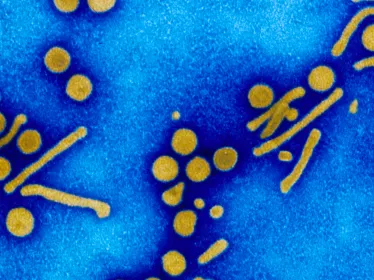 Fiches maladies - Hépatites virales - Institut Pasteur