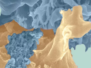 Fiches maladies - HTLV-I - Institut Pasteur
