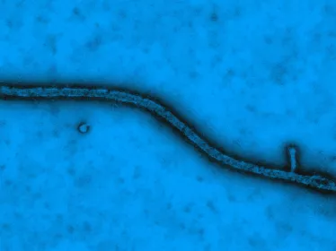 Ebola virus - Institut Pasteur