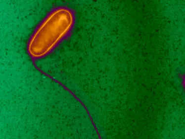 Fiches maladies - Légionellose - Institut Pasteur