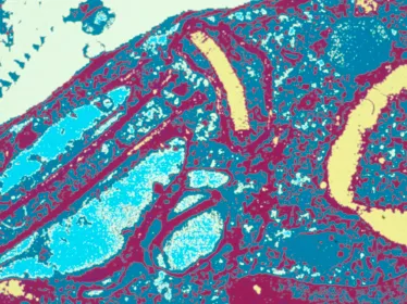Fiches maladies - Leishmanioses - Institut Pasteur