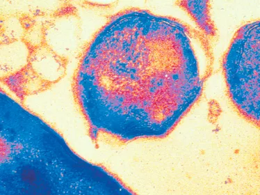 Fiches maladies - Lèpre - Institut Pasteur