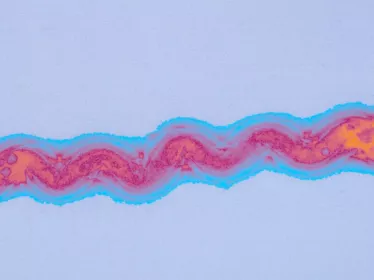 Fiches maladies - Leptospirose - Institut Pasteur