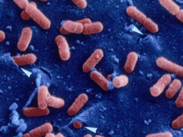 Fiches maladies - Listériose - Institut Pasteur