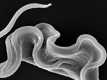 Fiches maladies - Maladie du sommeil - Institut Pasteur