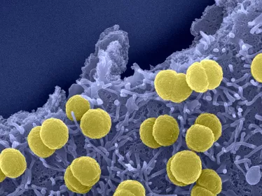 Fiches maladies - Méninges à méningocoques - Institut Pasteur
