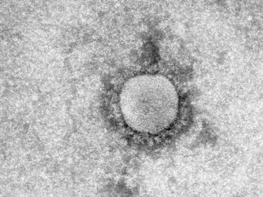 Fiches maladies - MERS-COV - Institut Pasteur