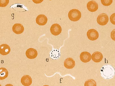 Institut Pasteur - Journal de la Recherche - Paludism