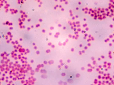 Fiches maladies - Sepsis Septicémie - Institut Pasteur