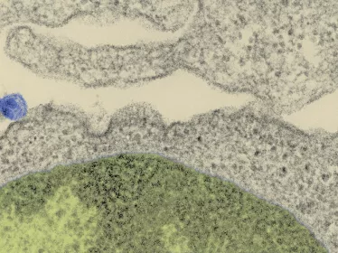 Fiches maladies - Sida VIH - Institut Pasteur